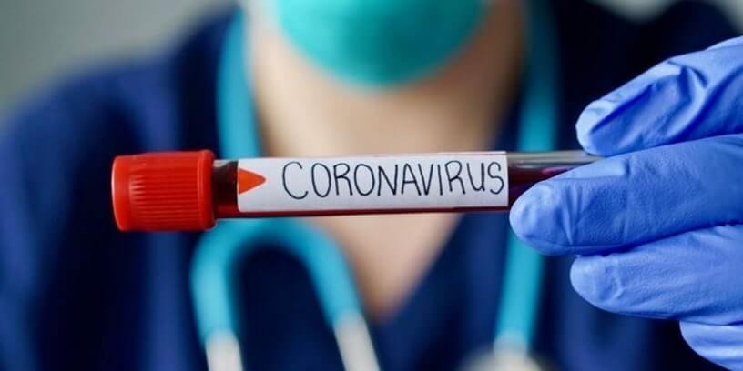 Un échantillon testé pour le coronavirus.