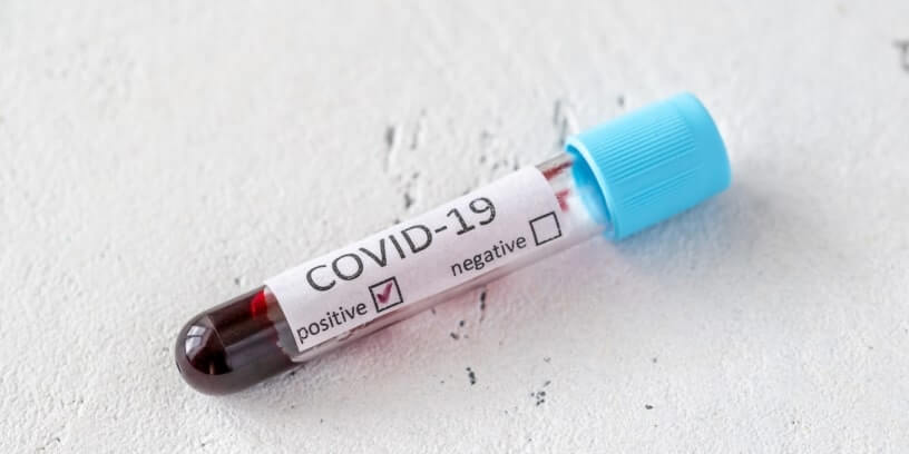 Un échantillon de sang positif au Covid-19